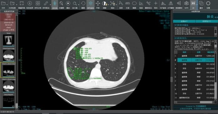 Ping-An-Smart-Healthcare-s-smart-image-reading-system-conduct-smart-image-reading